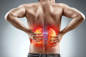 Pedras nos rins: entenda as causas, sintomas, prevenção e tratamentos